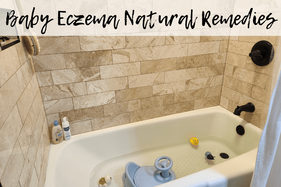 natural ways to clear baby eczema